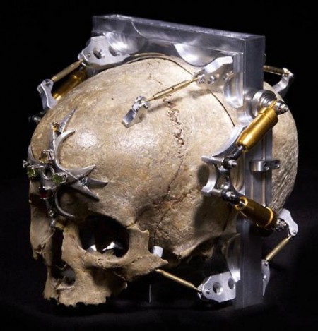 150 Year Old Skull Made Into Pinhole Camera